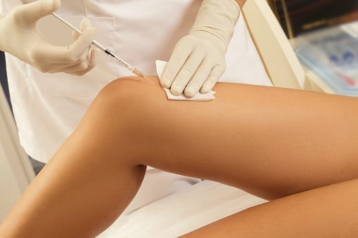 injection acide visco