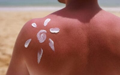 Pourquoi il ne faut pas s’exposer au soleil pendant l’été ?